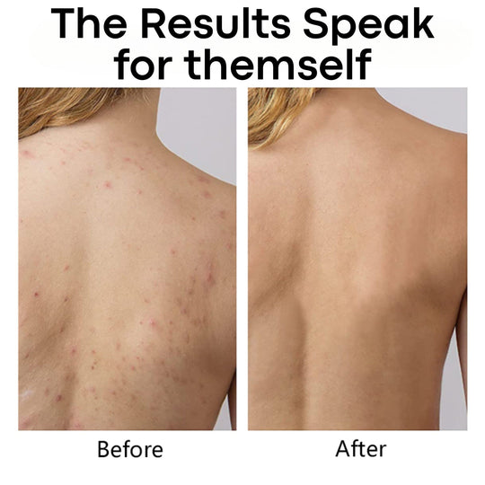 Hydrocolloid sheet roll Flexible