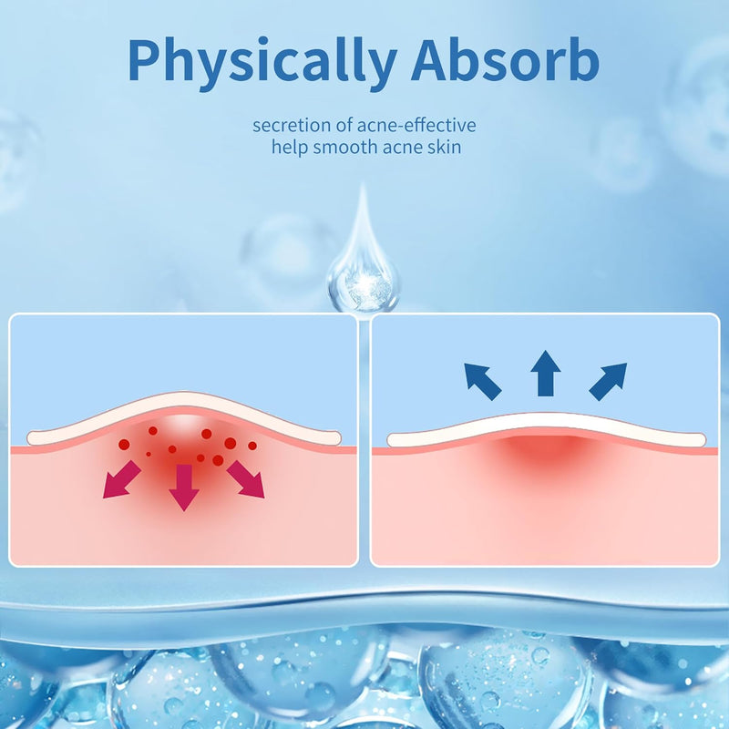 Hydrocolloid sheet roll Flexible