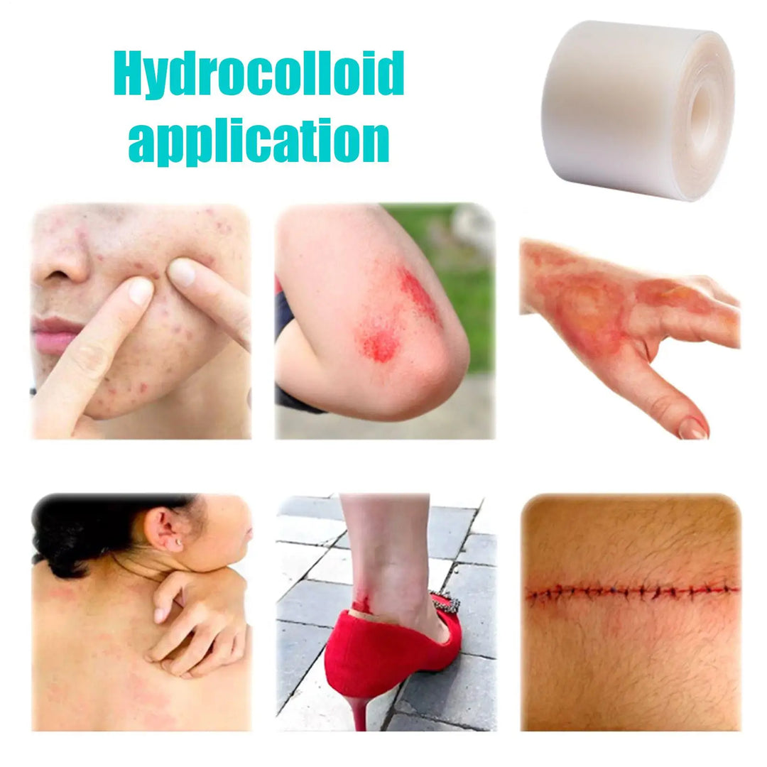 Hydrocolloid sheet roll Flexible