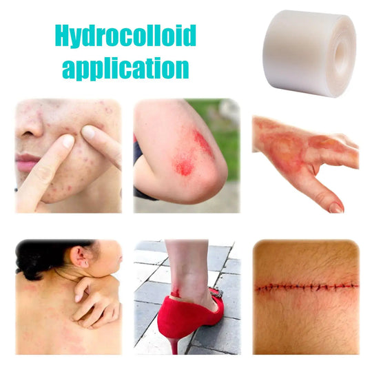 Hydrocolloid sheet roll Flexible
