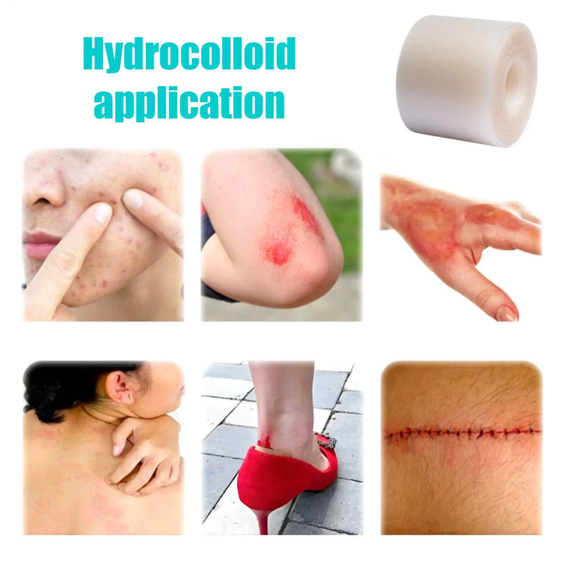 Hydrocolloid sheet roll Flexible